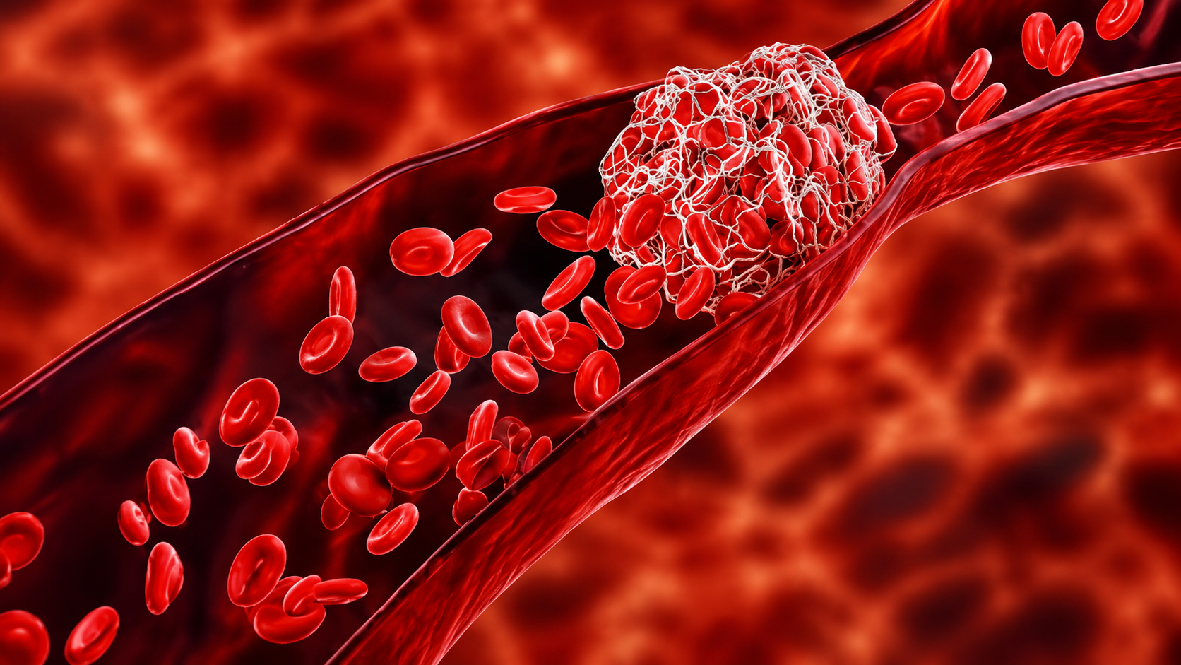 Blood Cancer Specialist Bhopal