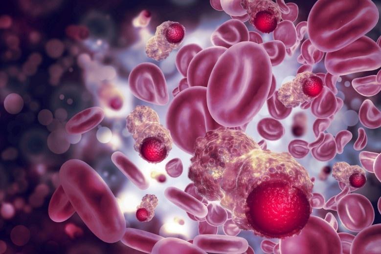 Leukemia Care